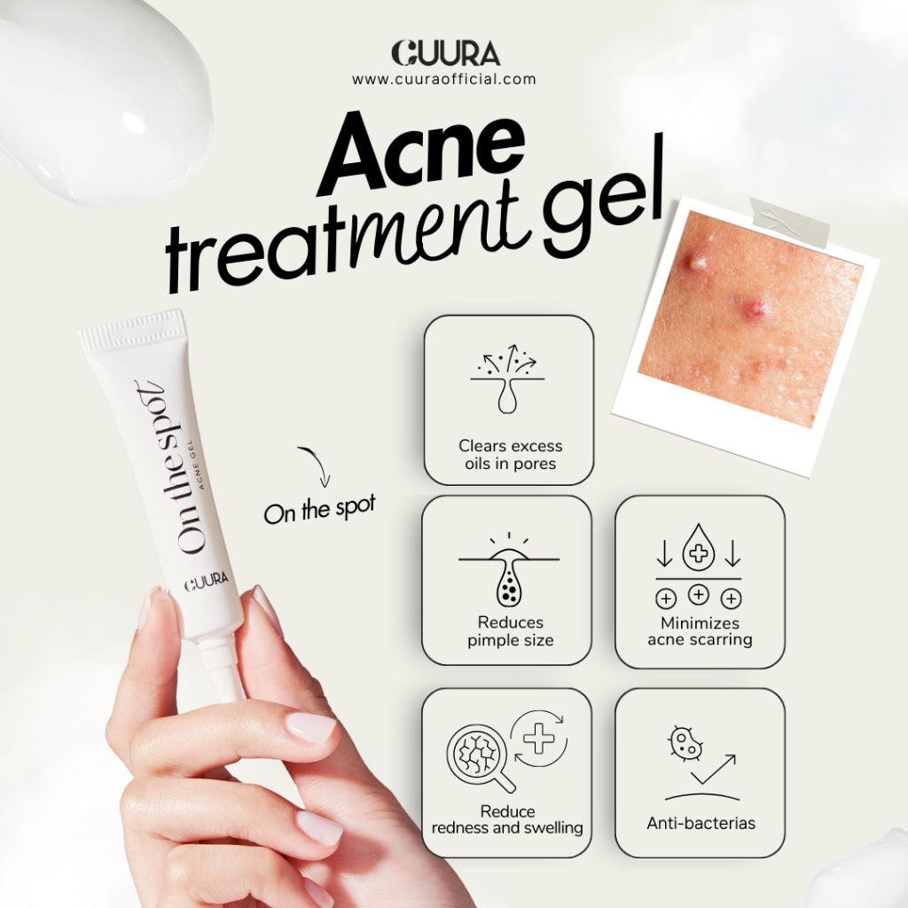 Cuura On the Spot (Acne Treatment Gel)